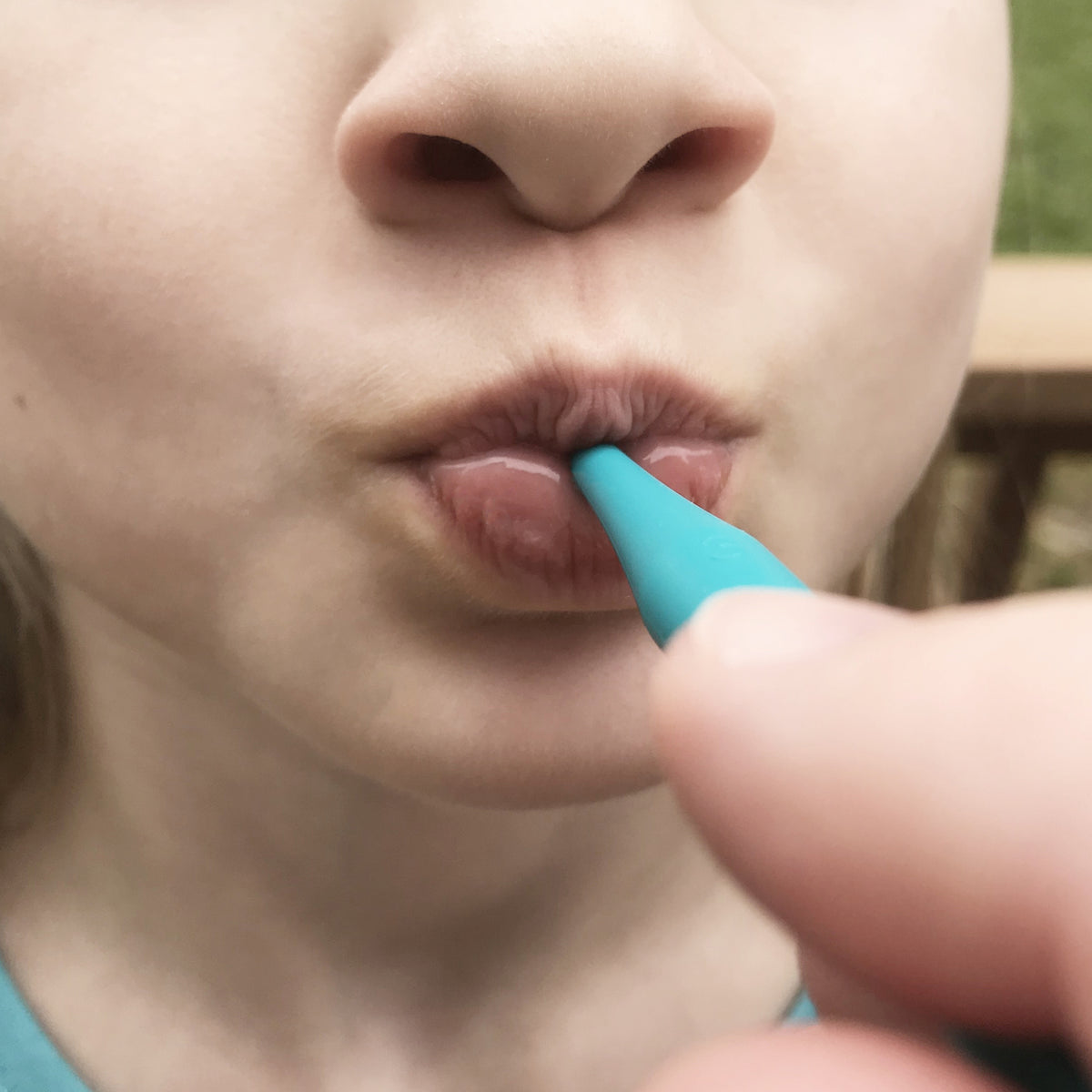 ARK&#39;s proButton™ Set for Lip Closure/Strength